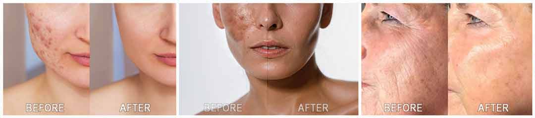 Kim's SkinCare Protocol Customer